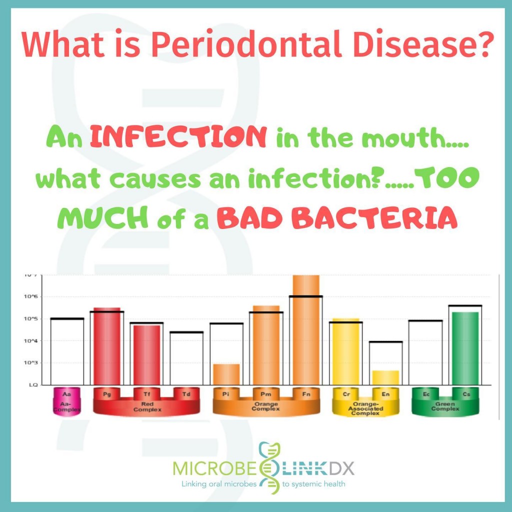 Periodontal Disease 1024x1024 