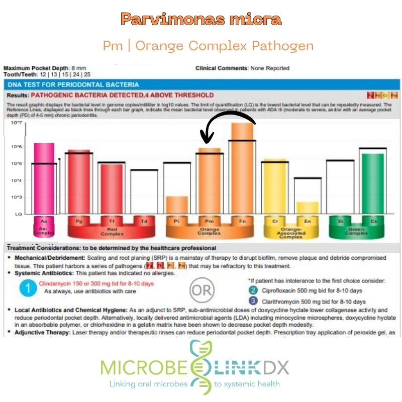 PM: Parvimonea Miora