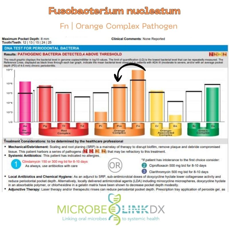 FN Fusobaotarium Nucleatum