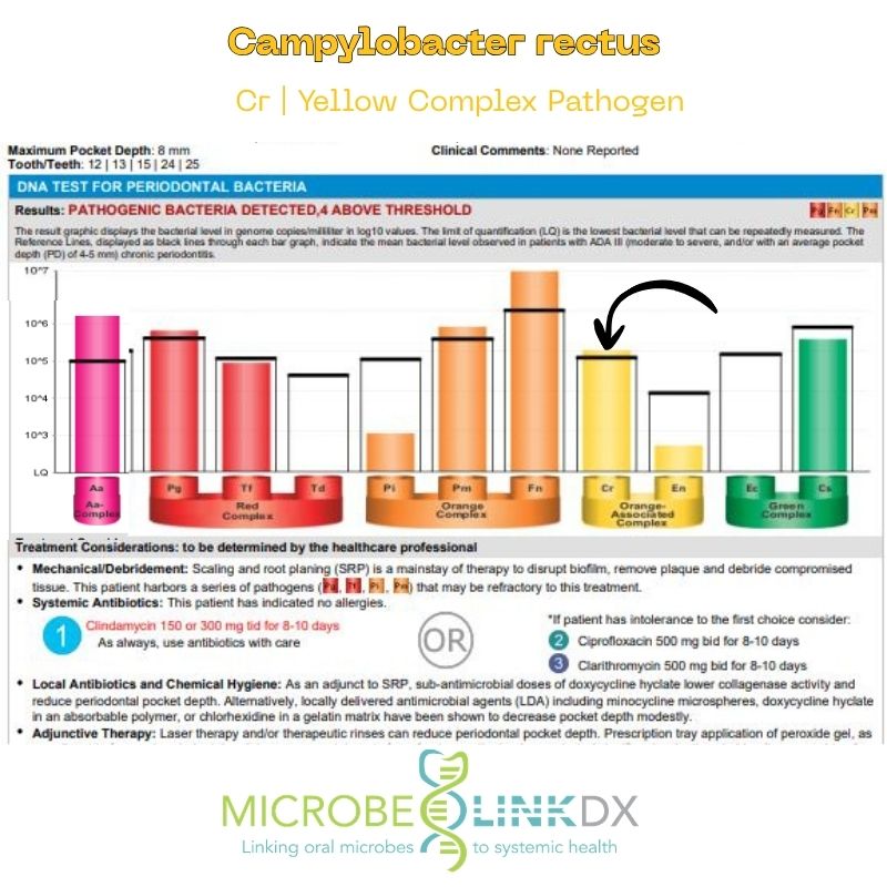 campylobacter-rectus-cr-yellow-complex-pathogen