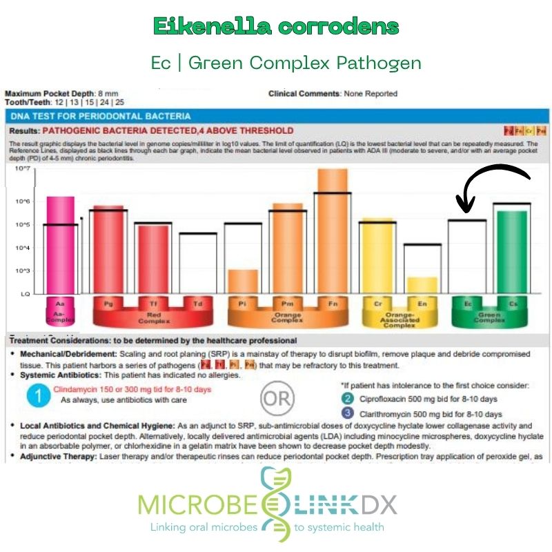 eikenella-corrodens-ec-green-complex-pathogen