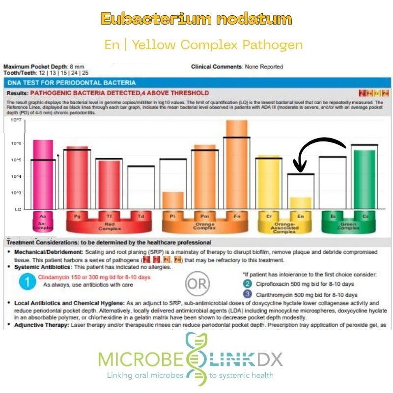 eubacterium-nodatum-en-yellow-complex-pathogen