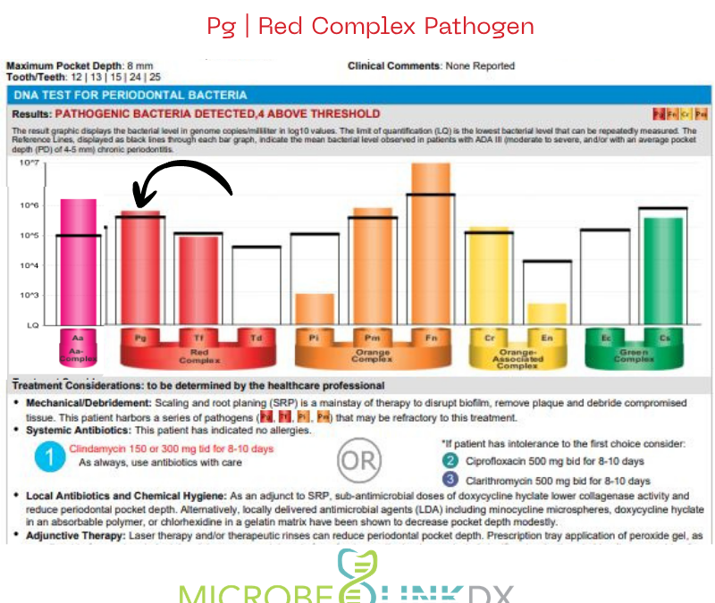 Porphyromonas gingivalis (Pg): The Arsonist