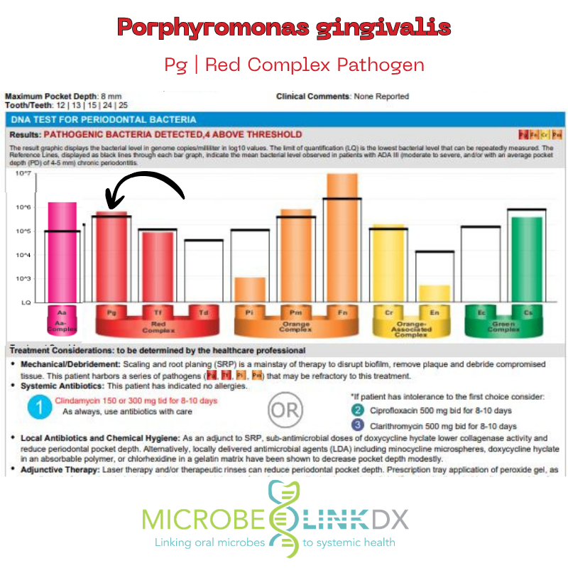 porphyromonas-gingivalis-pg-red-complex-pathogen