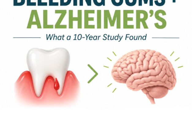 Bleeding on Probing & Alzheimer’s: What a New 10-Year Study Found